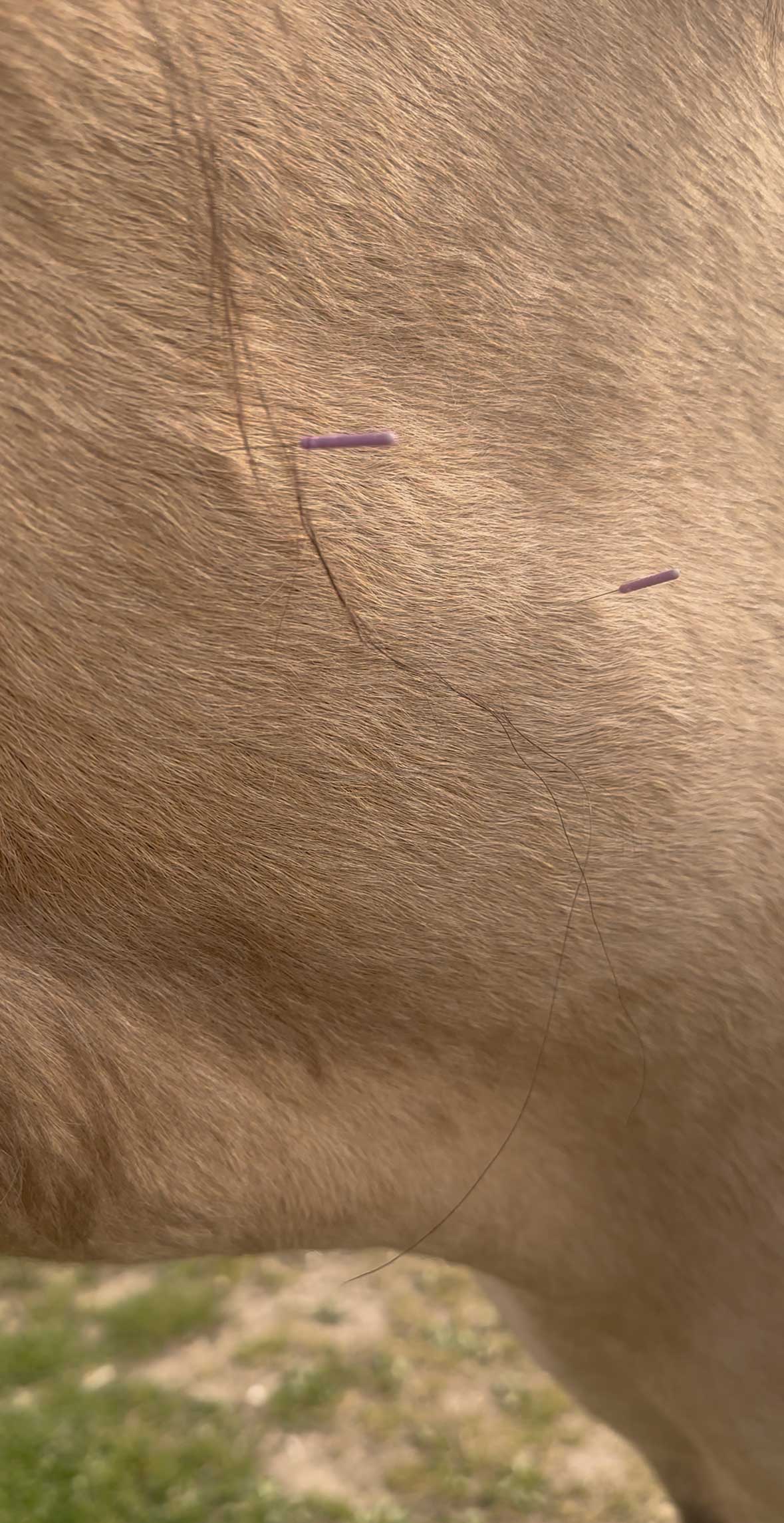 Dry Needling ist nicht Akupunktur – Warum die Chinesische Heilkunst tiefer wirkt als symptomorientiertes Nadeln